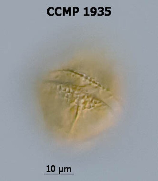 CCMP1935 | NCMA at Bigelow Laboratory