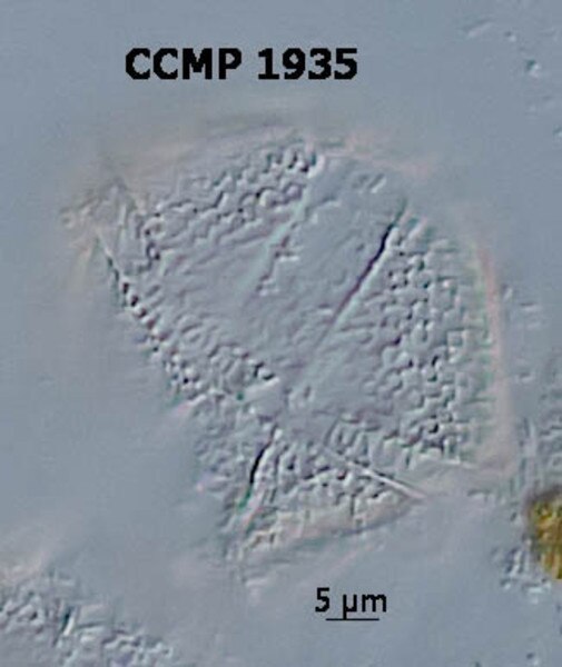 CCMP1935 | NCMA at Bigelow Laboratory