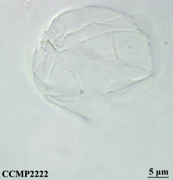 CCMP2222 | NCMA at Bigelow Laboratory