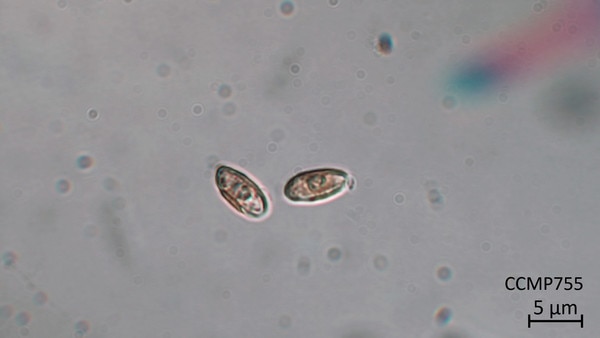 CCMP1413 | NCMA at Bigelow Laboratory